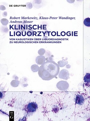cover image of Klinische Liquorzytologie